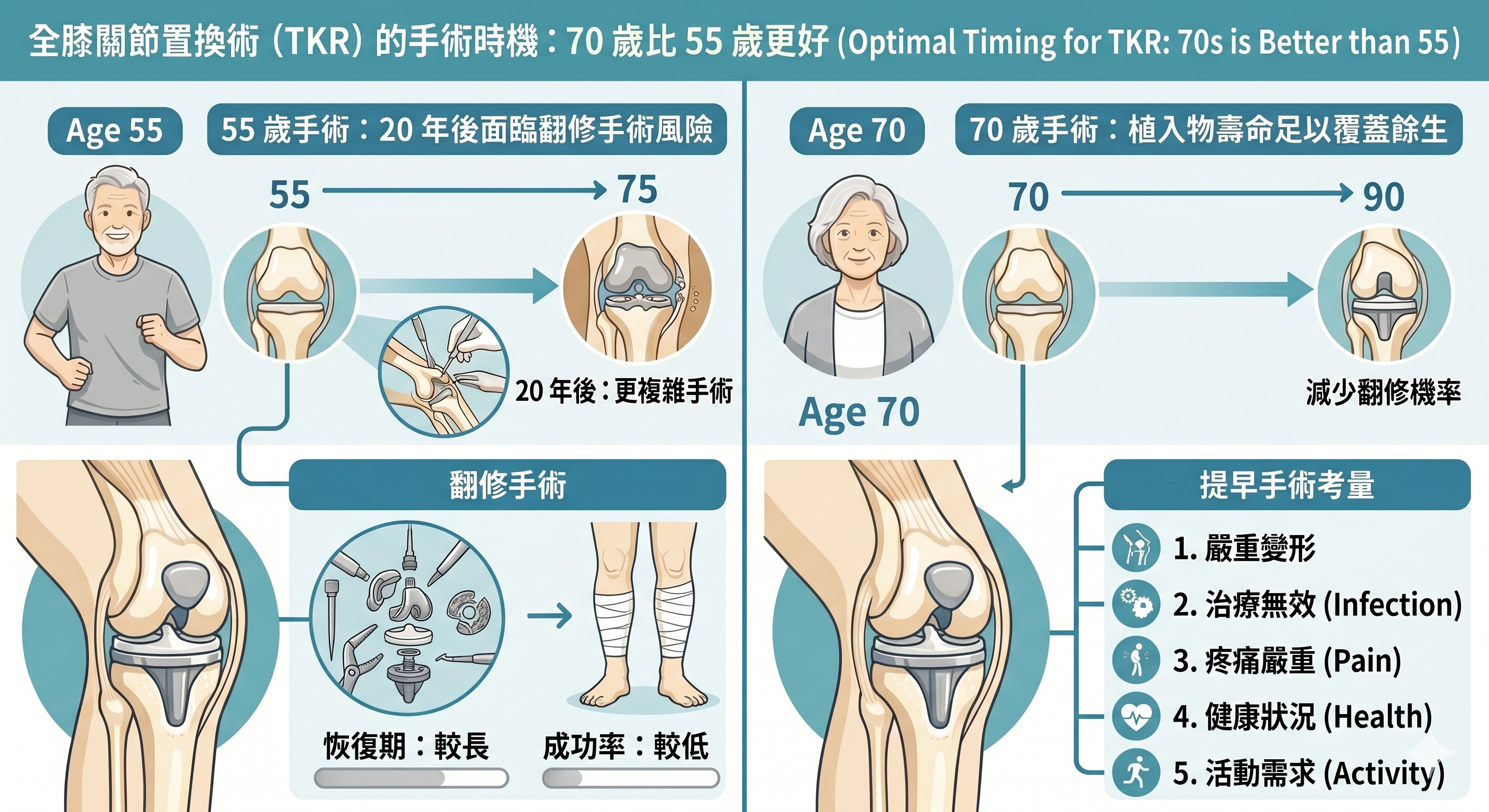 全膝關節置換術手術時機:70 歲比 55 歲更好的原因示意圖