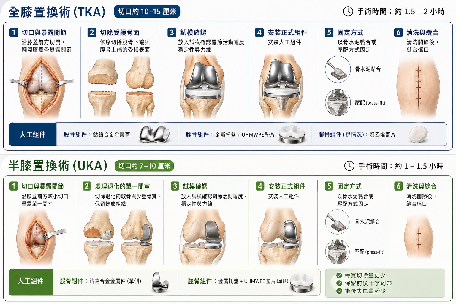 全膝置換術(TKA)與半膝置換術(UKA)手術步驟對比圖